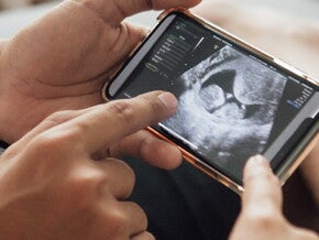 Der erste Ultraschall | Baby&me