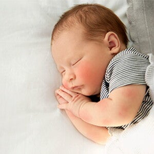 Allergievorsorge beim Baby | Baby&me