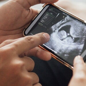 Der erste Ultraschall | Baby&me Der erste Ultraschall | Baby&me