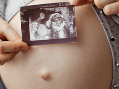 Geburtsterminrechner: Entbindungstermin berechnen|Baby&me 