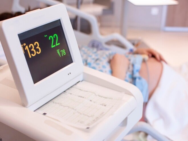 Nahaufnahme eines CTG-Monitors, im unscharfen Hintergrund liegt eine schwangere Frau im Bett. 