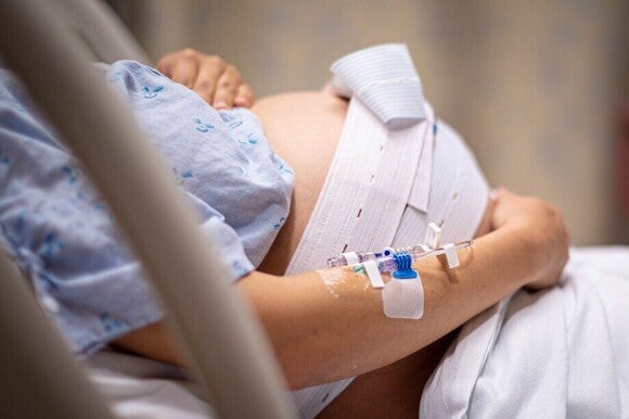 Eine schwangere Frau liegt im Krankenhausbett; um ihren Bauch sind die elastischen Gurte eines CTG-Geräts gespannt.